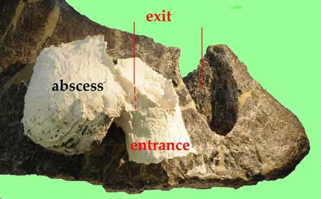 A fossil pubis bone of an Allosaurus. It shows a large entry and exit wound from a stegosaurus tail spike.  The white plaster is a cast of the
abscess from infection after the injury.  Image Credit: Robert Bakker